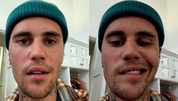 Justin Bieber confirmó a través de un video que sufre de parálisis facial. (Foto: Instagram)