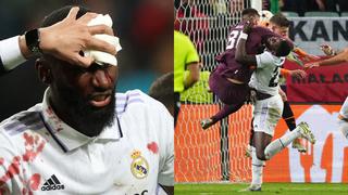 Imagen susceptible: así quedó el ojo de Rüdiger tras su gol con el Real Madrid