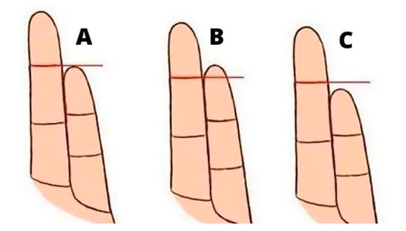 La forma de tu dedo meñique revela el perfil exacto de tu comportamiento | Foto: genial.guru