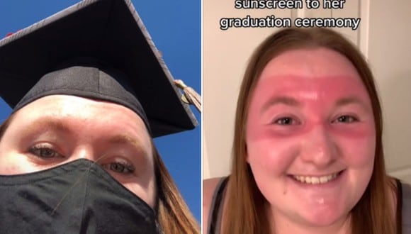 Gran impacto ha generado en Internet la apariencia que ‘ganó’ una joven luego de no usar bloqueador en el día de su graduación. (Foto: @carsynkouns / TikTok)