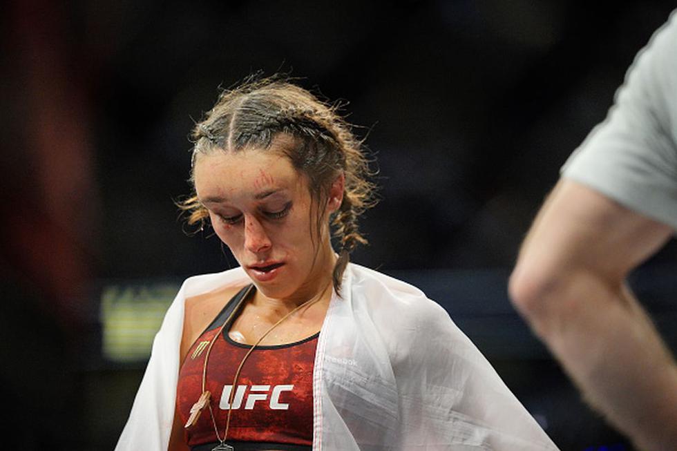 Ufc 248 Asi Quedo El Rostro De Joanna Jedrzejczyk Luego De Caer Ante Weili Zhang Fotos Full Deportes Depor