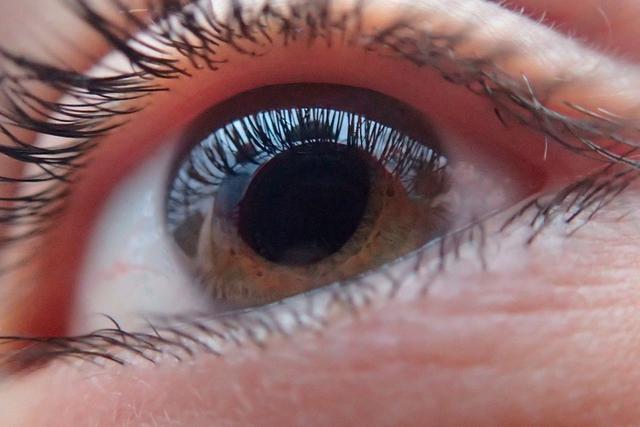 Es importante señalar que la única persona calificada que puede determinar el estado de tus ojos es un oftalmólogo. (Pixabay)