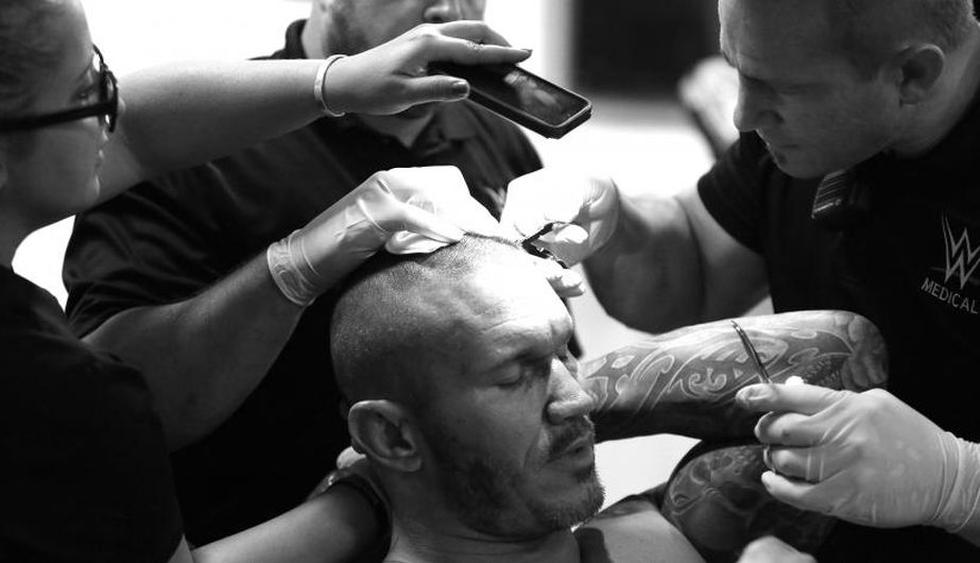 Randy Orton recibió diez grapas en la cabeza por los golpes de Brock Lesnar. (WWE)