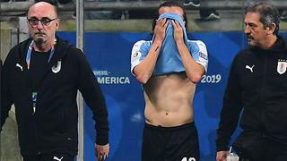 Uruguay sigue sufriendo a Japón:Diego Laxalt esduda para el resto de la Copa América