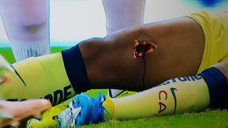 El tejido quedó expuesto: la lesión de Gio dos Santos que da la vuelta al mundo [VIDEO]