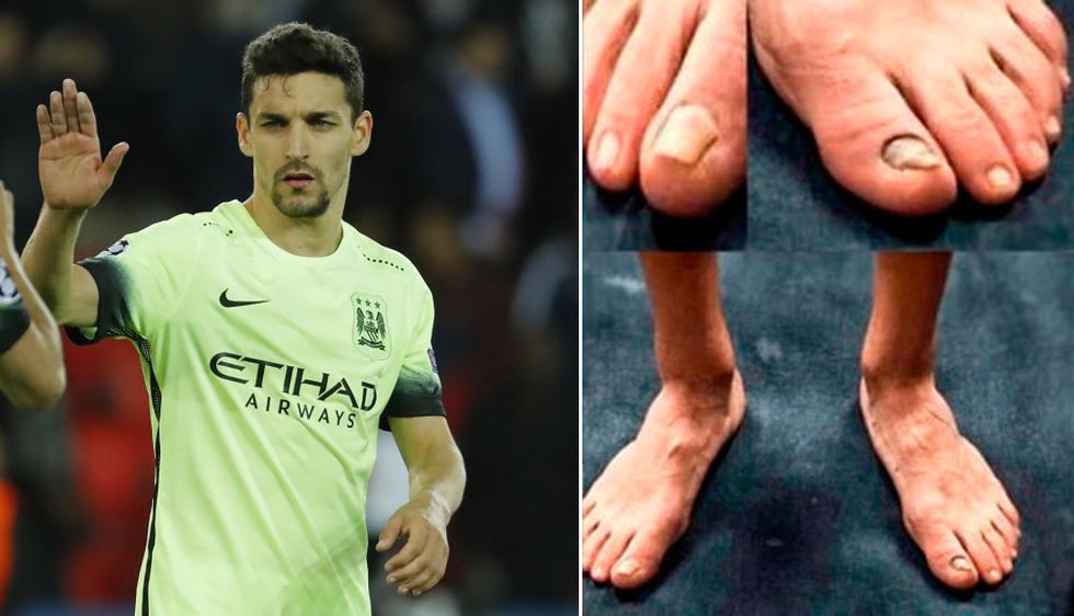 Gerard Piqué-Barcelona. El defensor catalán conquistó a Shakira, pero queda claro que en la primera cita no le vio los pies. (AP/Difusión)