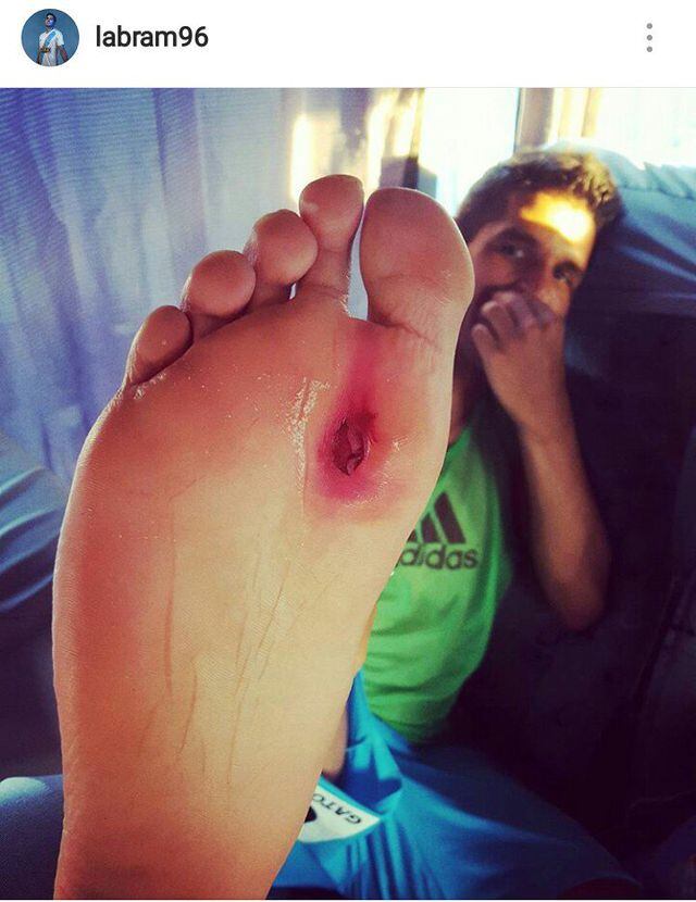 Liga 1: Sporting Cristal: Luis Abram publicó el terrible efecto de ...