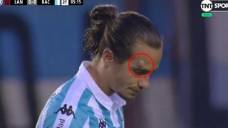 ¡Insólito! Jugador de Racing sufrió tremenda lesión tras codazo en la Superliga argentina [VIDEO]