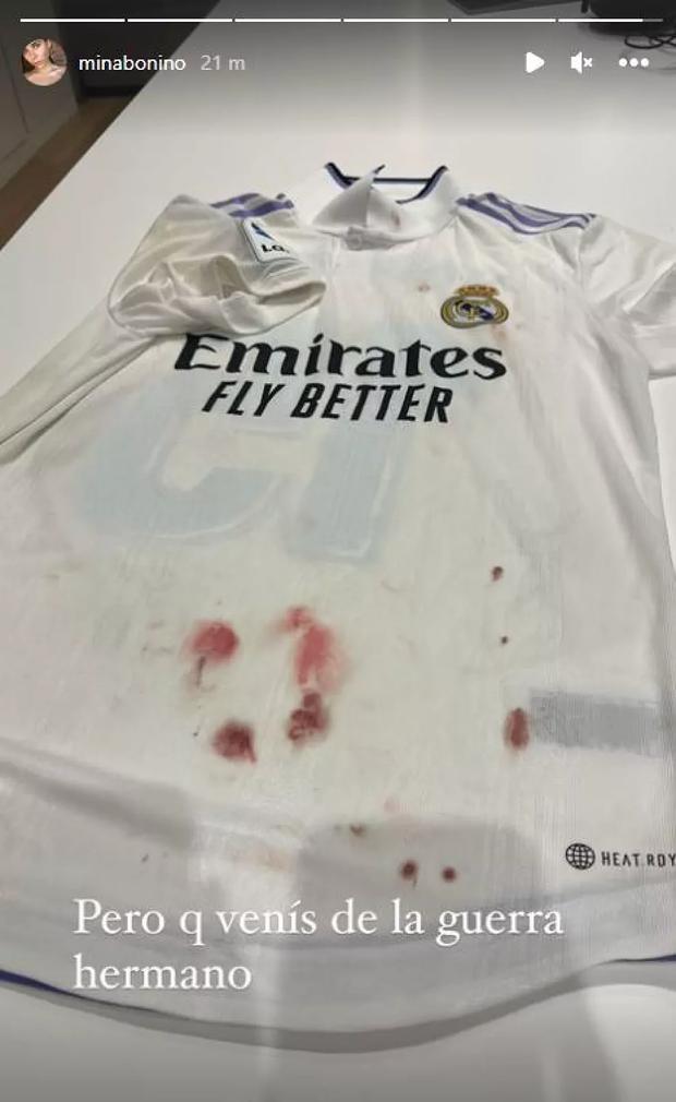 Camiseta manchada de sangre de Valverde. (Foto: Captura)