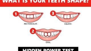 Test de personalidad te puede mostrar rasgos de tu comportamiento según la forma de tus dientes 