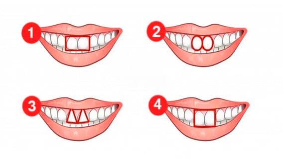 Simplemente elige cuál de todas las opciones se parece a la forma de tus dientes y conocerás los resultados del test de personalidad.| Foto: namastest