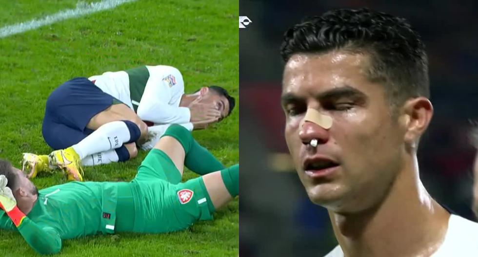 Cristiano Ronaldo coberto de sangue em Portugal vs. República Checa: avançado português acabou lesionado no jogo da UEFA Nations League |  VÍDEO |  Liga das Nações |  FUTEBOL INTERNACIONAL