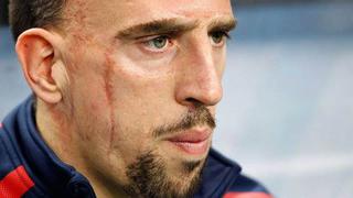 Tras el susto, sanción: Ribéry fue multado luego de sufrir accidente de auto