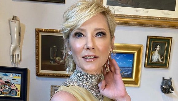 Anne Heche protagonizó un accidente automovilístico que la dejó en coma. (Foto: Instagram)