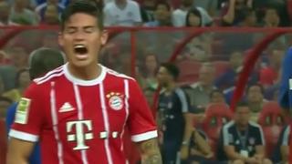 James Rodríguez falló una, y otra, y otra, explotó de rabia y su reacción sorprendió a todos