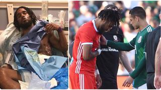 Lo mandó al hospital: Javier 'Chicharito' Hernández le perforó un pulmón al capitán de Gales en amistoso