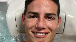 Notoriamente golpeado: James mostró cómo quedó su rostro tras recibir peligrosa falta