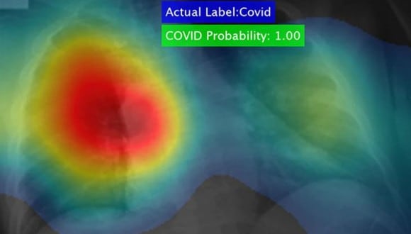La Universidad de Dayton difundió una imagen del software capaz de detectar el coronavirus.
