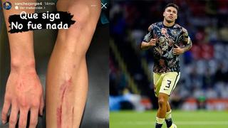 Eso debió doler: la herida en la pierna de Jorge Sánchez luego del clásico ante Chivas