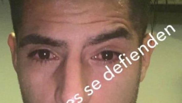 Carlos Zambrano compartió una foto de como quedaron sus ojos tras los incidentes en el Mineirao. (Foto: Instagram)