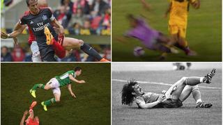 Galería no apta para sensibles: las 13 lesiones más escalofriantes en la historia del fútbol [FOTOS]