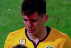La final, al rojo vivo: Parot terminó sangrando tras codazo deIzquierdoz por final de la Supercopa [VIDEO]