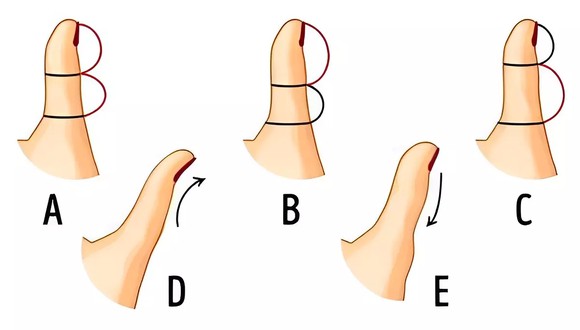 Test visual: el tamaño de tu dedo pulgar revelará qué tipo de persona eres y cómo piensas (Foto: GenialGuru).