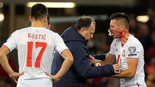 ¡Impactante! Taylor le rompió la nariz a Dusan Tadic en el Gales-Serbia [VIDEO]