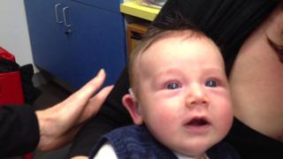 Padres graban el momento en el que su bebé con discapacidad auditiva logra escuchar por primera vez