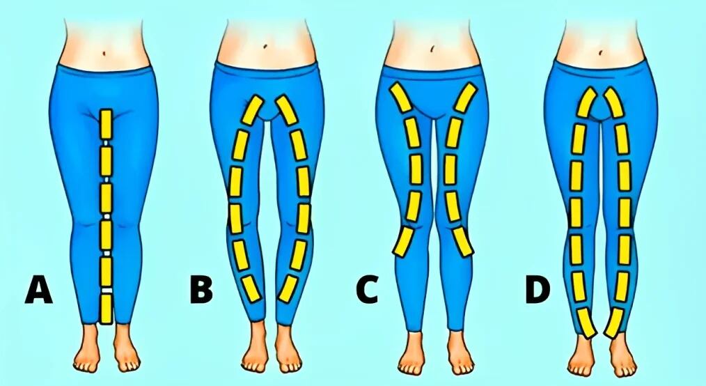 La forma como son tus piernas revelará si eres una persona cariñosa con tu pareja. (Foto: Pinterest)