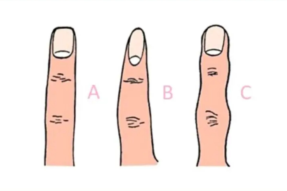 TEST VISUAL | En esta imagen se aprecia tres dedos con formas distintas. (Foto: namastest.net)