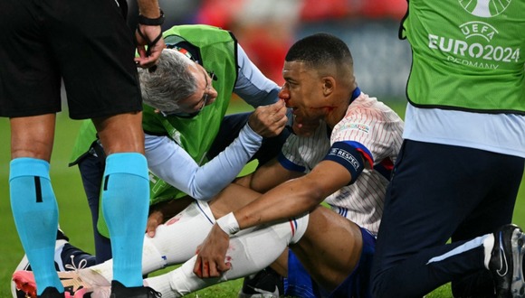 Kylian Mbappé sufrió una lesión en la nariz en el Francia vs. Austria de la Eurocopa. Foto: AFP