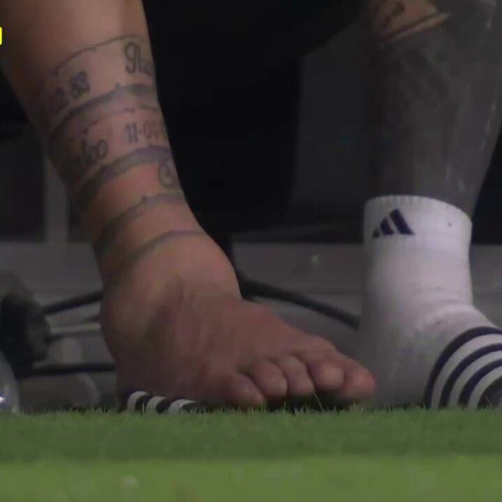 El tobillo de Messi tras la final de la Copa América. (X)