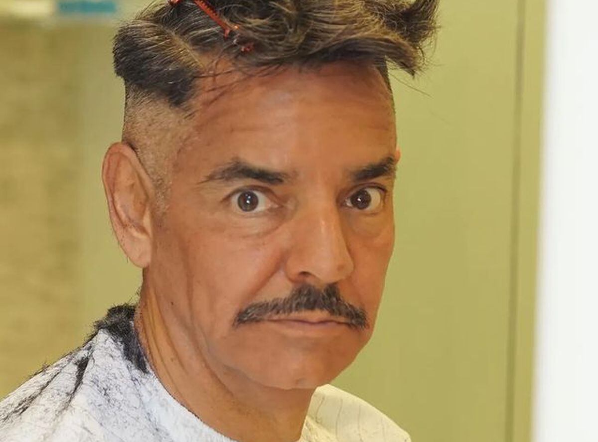 El actor Eugenio Derbez contó detalles sobre su accidente en el brazo y hombro (Foto: Eugenio Derbez / Instagram)