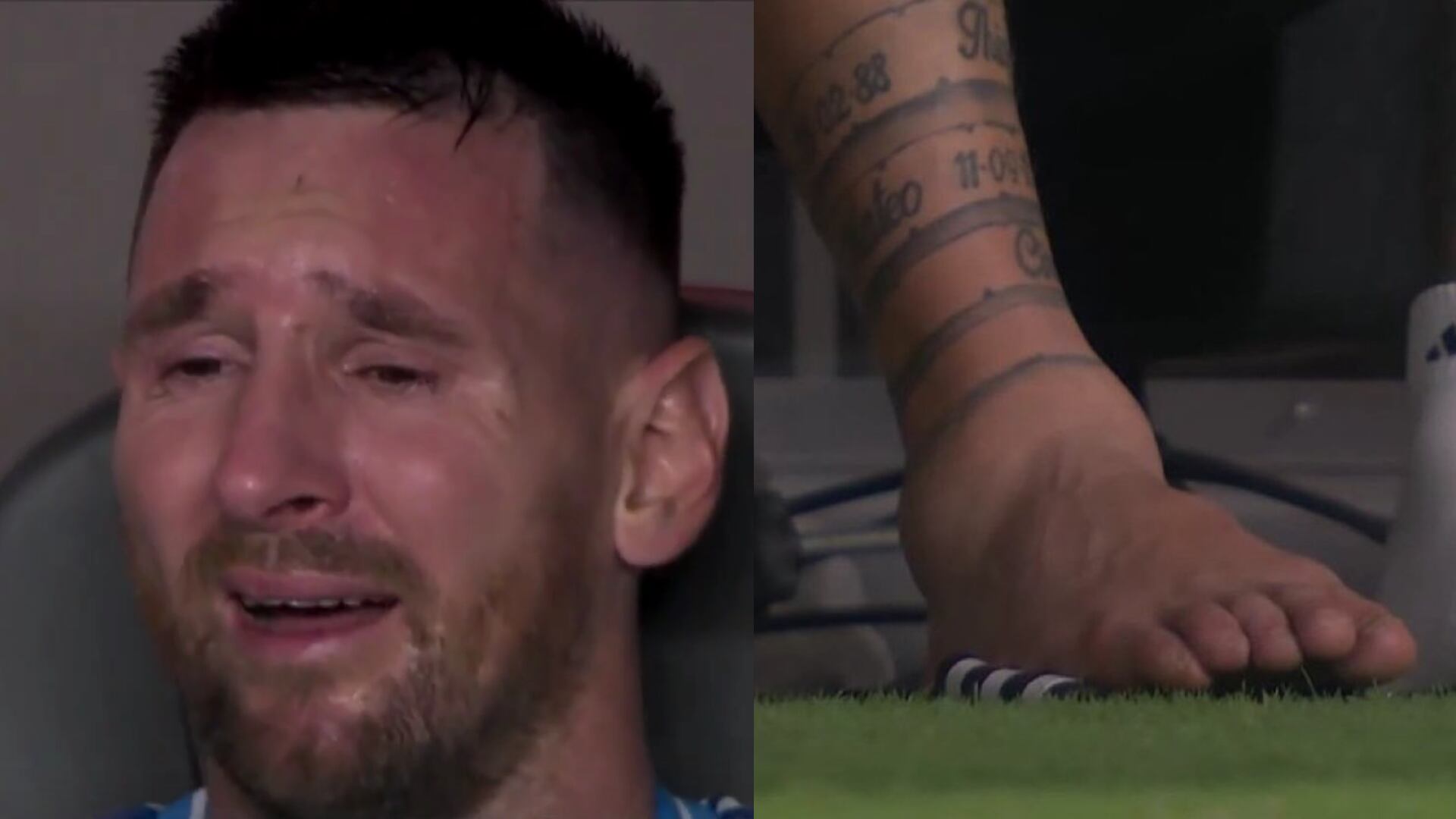 Lionel Messi se lesionó en la final de la Copa América entre Argentina y Colombia.