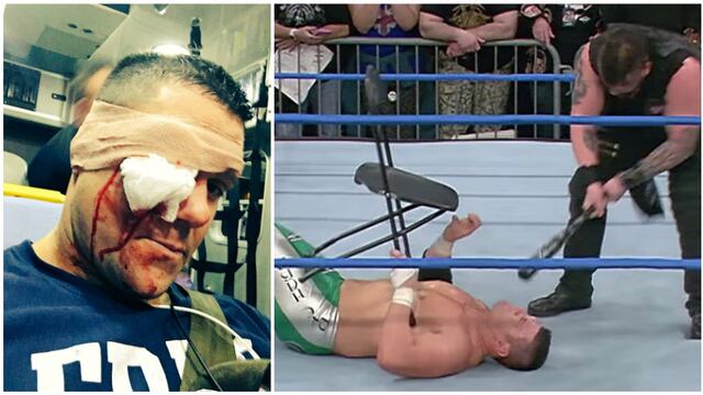 De la que se salvó: luchador casi pierde el ojo por falta de puntería de su compañero en el ring [VIDEO]