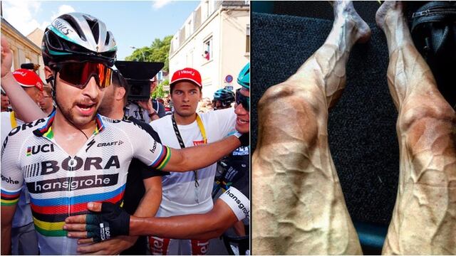 Así acabaron las piernas de un ciclista polaco tras 16 etapas en el Tour de Francia 2017
