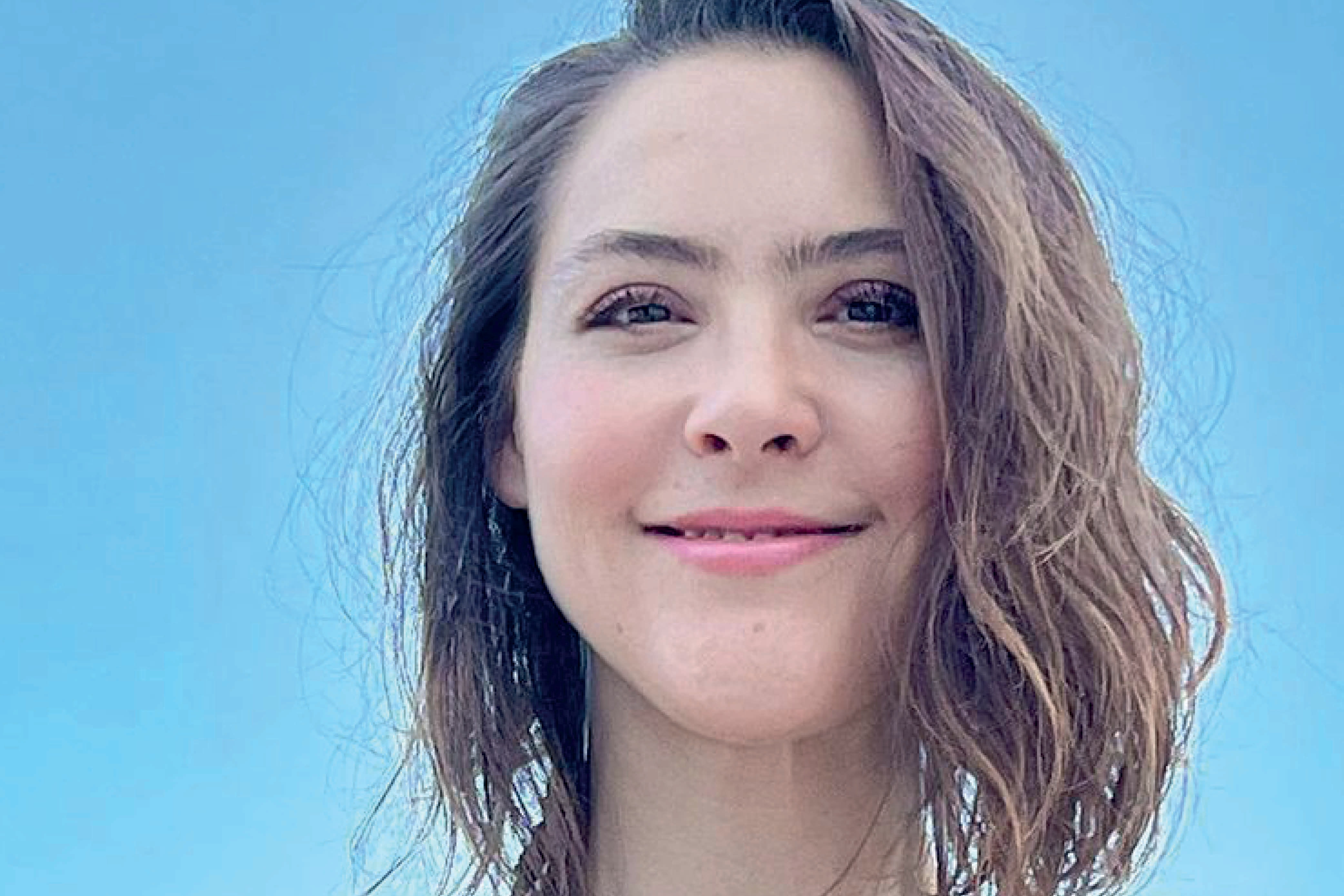 Lynda Thomas padece una extraña condición que debilita su organismo (Foto: Lynda Thomas / Instagram)