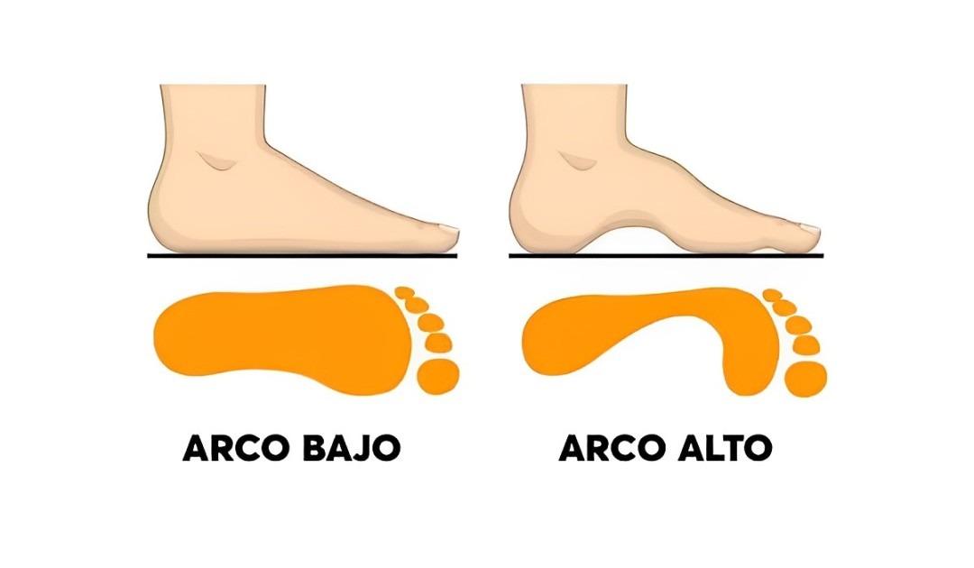 Test de personalidad: descubre cómo eres, según la forma del arco de tu pie. (Foto: Pinterest)
