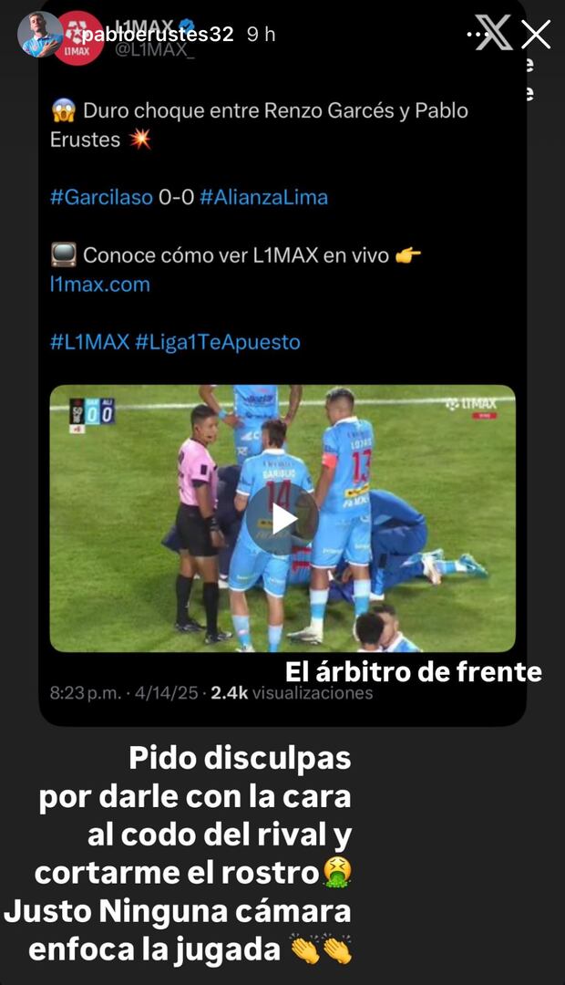 Pablo Erustes aprovechó su cuenta de Instagram para encender la polémica por una jugada que no vio el árbitro Joel Alarcón. (Captura: Instagram)