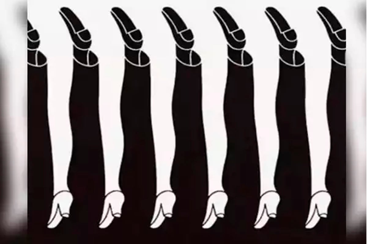 En la imagen se visualizan piernas masculinas y femeninas, pero debes decirnos cuál llamó tu atención para conocer los resultados del test de personalidad.| Foto: Shigeo Fukuda