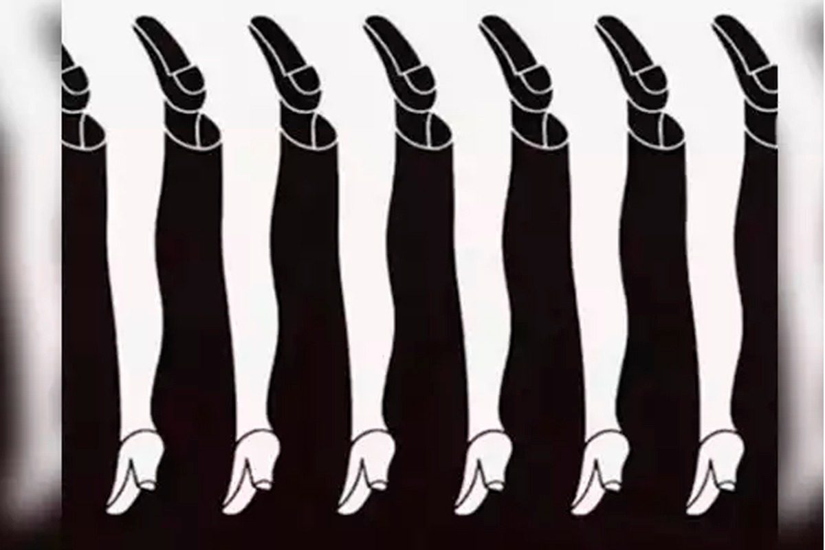 En la imagen se visualizan piernas masculinas y femeninas, pero debes decirnos cuál llamó tu atención para conocer los resultados del test de personalidad.| Foto: Shigeo Fukuda