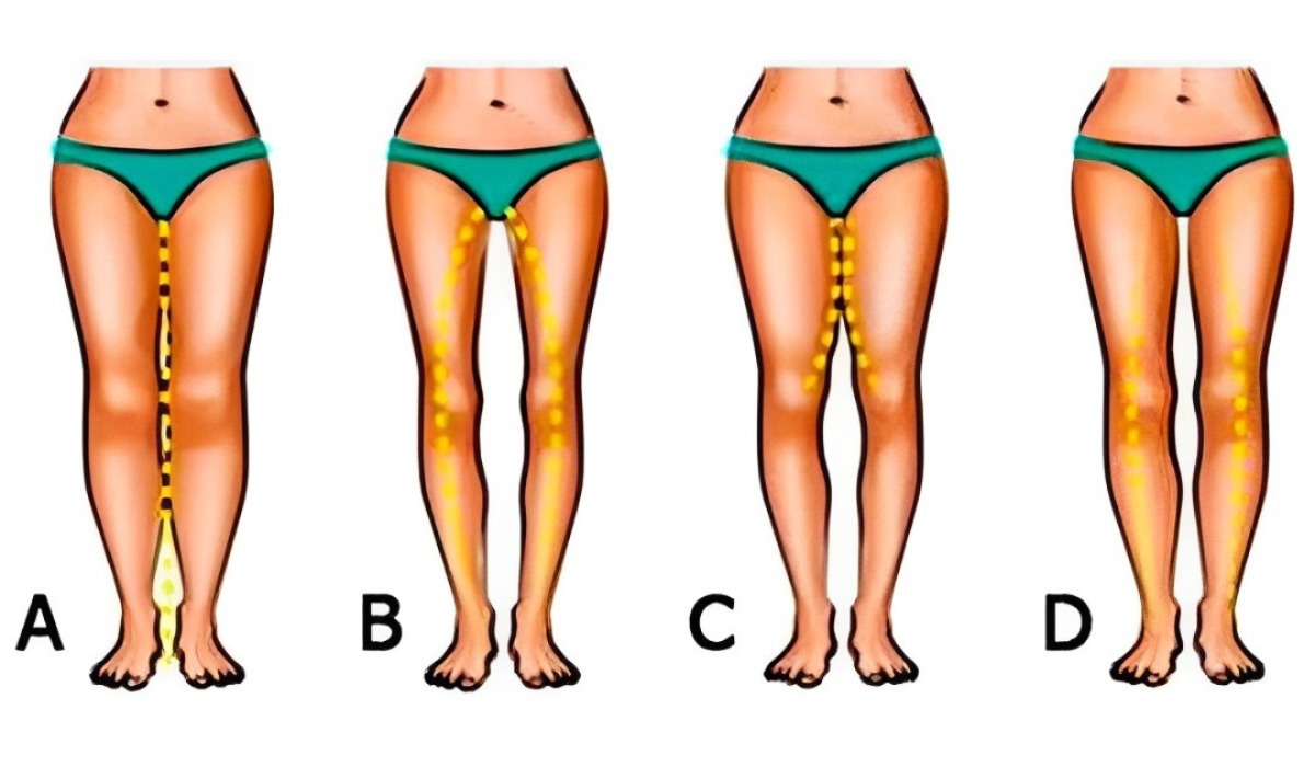 La forma de tus piernas en este test de personalidad te hará saber cómo te irá en el amor (Foto: Namastest).