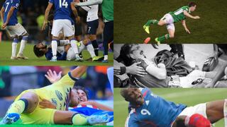 Imágenes pueden herir susceptibilidades: las lesiones más desgarradoras nunca antes vistas en el fútbol [FOTOS]