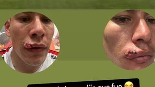 “Acción de juego dijo que fue, increíble”: González enseñó el corte que sufrió en Mannucci-Melgar