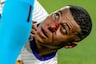 Tras salir con sangre en el rostro, ¿cómo jugará Mbappé sus próximos partidos en la Eurocopa?