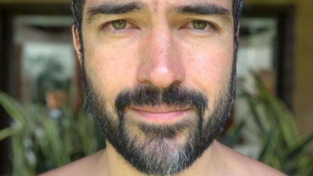 Por qué Alfonso Herrera se separó de su esposa Diana Vázquez