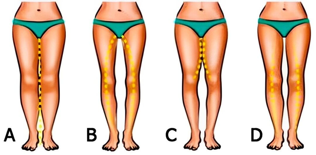 Test de personalidad: la forma de tus piernas te hará saber cómo te irá en el amor (Foto: Namastest).