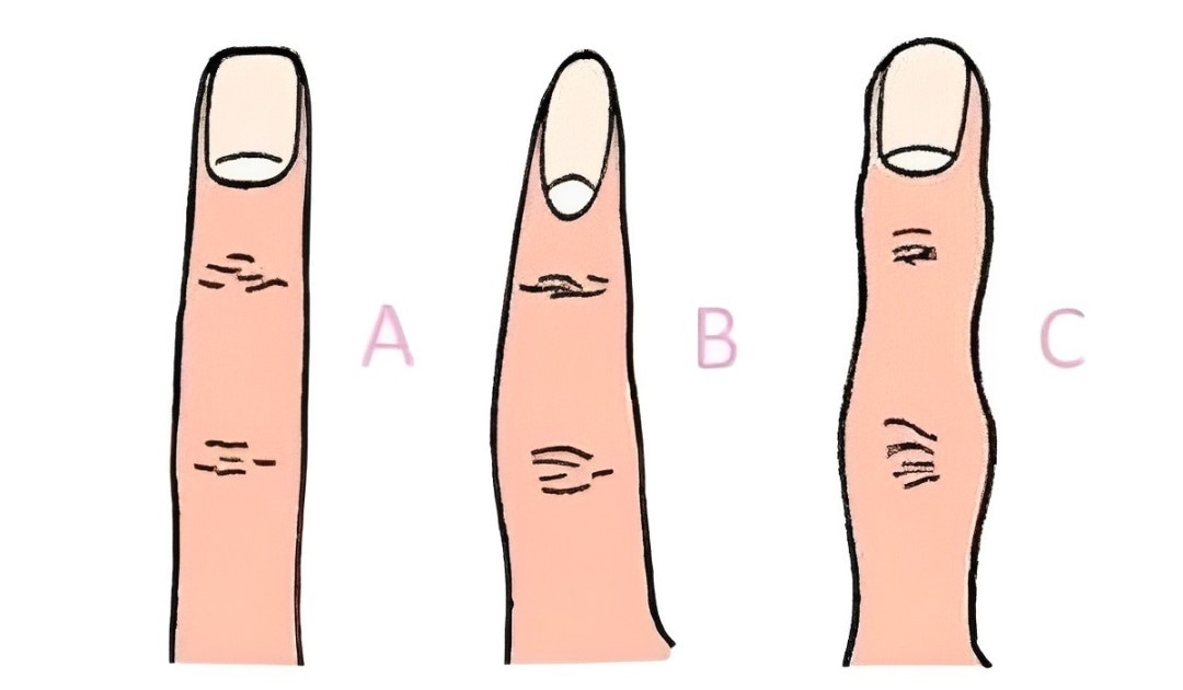 Test de personalidad: la forma de tu dedo revela tu carácter. (Foto: Facebook)