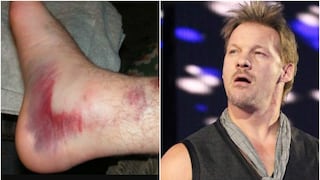 ¿Chris Jericho se perdería WrestleMania 33 por lesión en el tobillo?